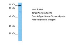 ARHGEF16 Antibody, Novus Biologicals 100 &mu;L | Buy Online | Novus Biologicals | Fisher Scientific